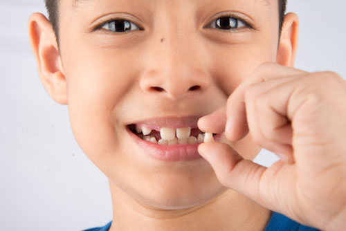 Tình trạng nghiến răng sẽ biến mất khi con lớn lên hoặc mọc đầy đủ răng vĩnh viễn