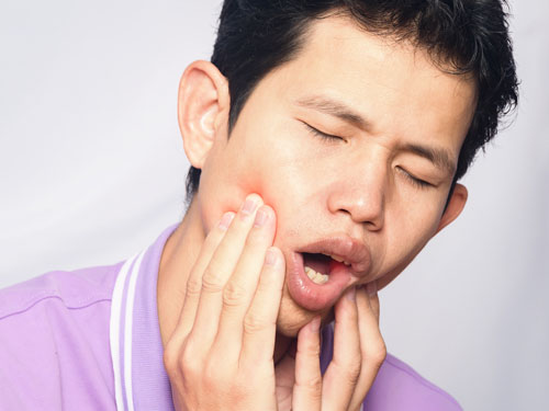 Viêm tủy răng gây ra những cơn đau nhức dai dẳng