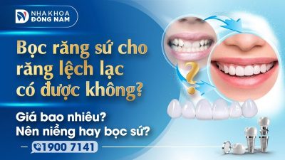 Bọc răng sứ cho răng lệch lạc có được không