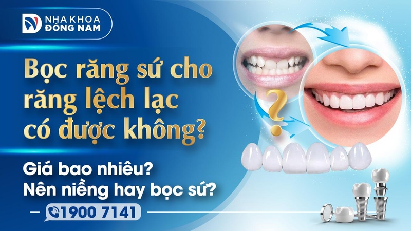 Bọc răng sứ cho răng lệch lạc có được không