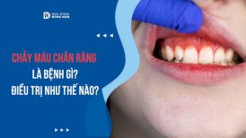 Chảy máu chân răng là bệnh gì? Điều trị như thế nào?