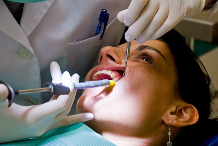 Nhổ răng sẽ được gây tê trước nên hoàn toàn không thấy đau nhức
