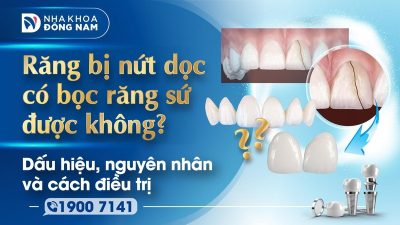 Răng bị nứt dọc có bọc răng sứ được không