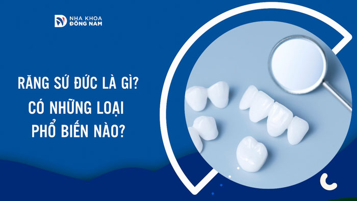 Răng sứ Đức là gì? Có những loại phổ biến nào?