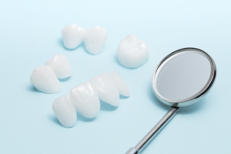 Răng toàn sứ được làm hoàn toàn từ khối sứ nguyên chất