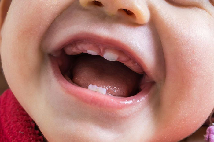 Khoảng 6 tháng tuổi trẻ bắt đầu mọc răng