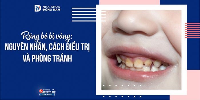 Nguyên nhân, cách điều trị và phòng tránh tình trạng răng bé bị vàng