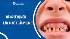 Răng bé bị mòn cha mẹ cần làm gì để khắc phục?