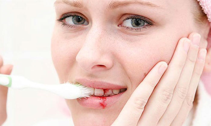 Chải răng sai cách dễ làm tổn thương nướu gây đau ngứa khó chịu
