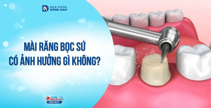 Mài răng bọc sứ có ảnh hưởng gì không?