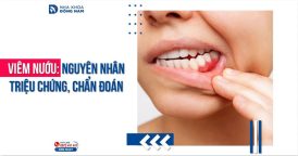 Nguyên nhân triệu chứng và phương pháp chẩn đoán viêm nướu răng
