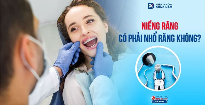 Niềng răng có phải nhổ răng không?