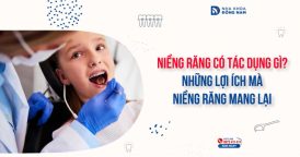 Niềng răng có tác dụng gì? Những lợi ích mà niềng răng mang lại