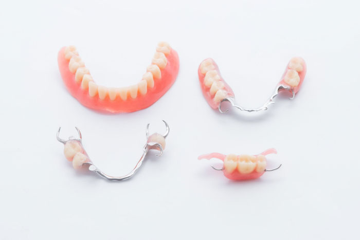 Phương pháp làm răng giả tháo lắp