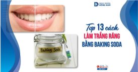 Top 13 cách làm trắng răng bằng Baking soda