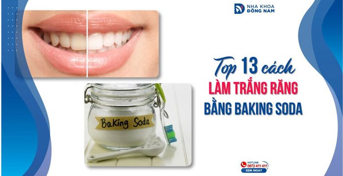 Top 13 cách làm trắng răng bằng Baking soda