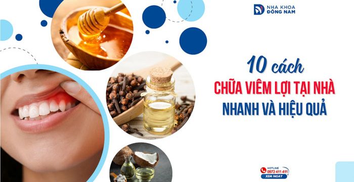 Cách chữa viêm lợi tại nhà nhanh và hiệu quả