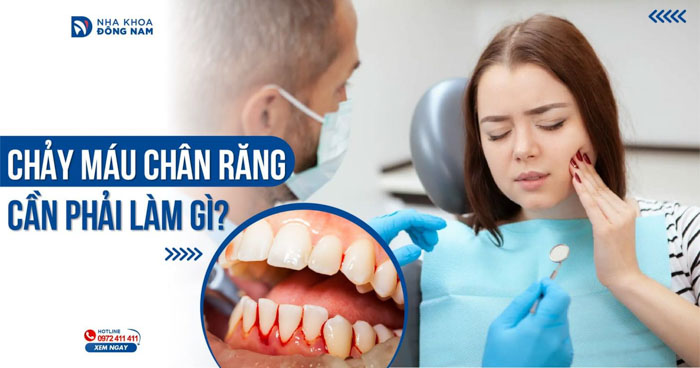 Chảy máu chân răng cần phải làm gì?