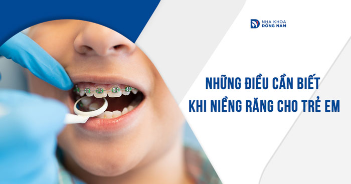Những điều cần biết khi niềng răng cho trẻ em
