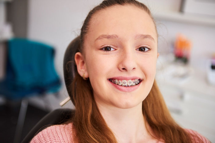 Niềng răng cho trẻ giúp sớm khắc phục các vấn đề về răng