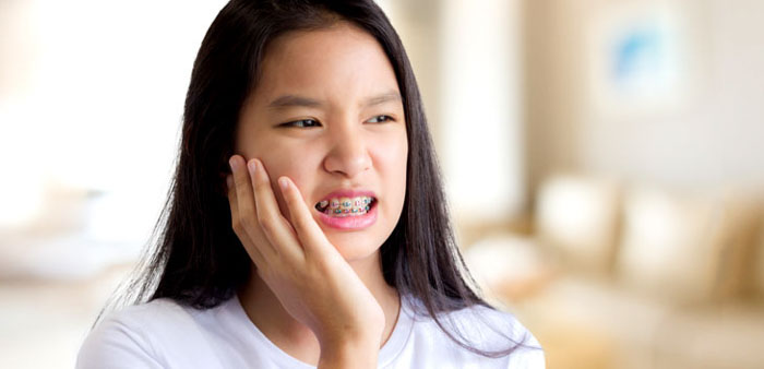 Răng có thể bị ê nhức nhẹ trong thời gian đầu đeo khí cụ