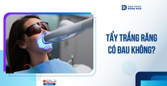 Tẩy trắng răng có đau không?