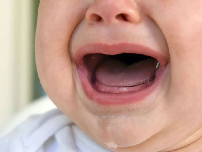 Trẻ mọc răng thường xuyên bị chảy nhiều nước dãi