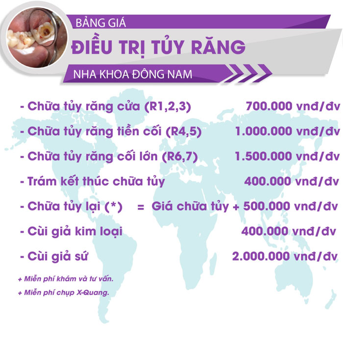 Bảng giá điều trị tủy răng