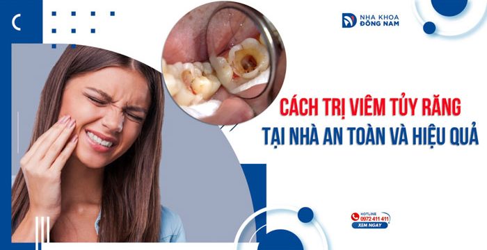 Cách trị viêm tủy răng tại nhà an toàn và hiệu quả
