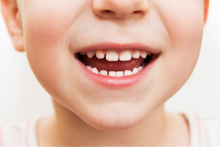 Chải răng đúng cách giúp nâng cao sức khỏe răng miệng