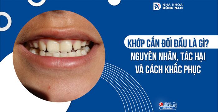 Khớp cắn đối đầu là gì? Nguyên nhân, tác hại và cách khắc phục