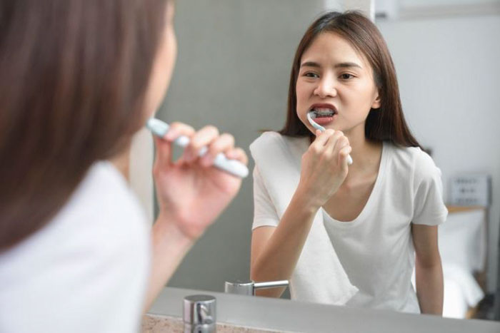 Vệ sinh răng sai cách rất dễ làm bung sút khí cụ chỉnh nha