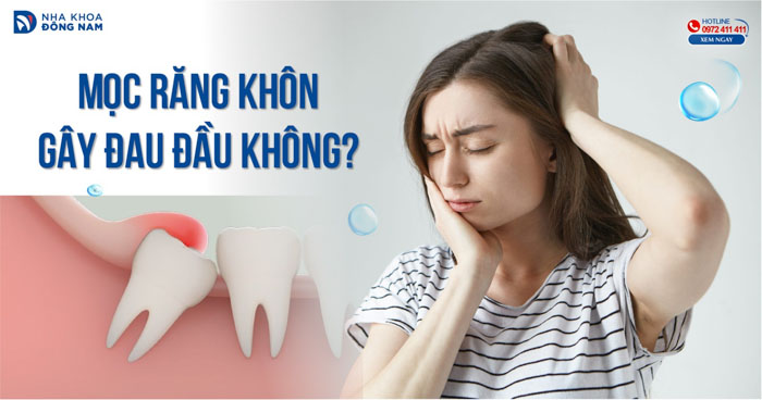 Mọc răng khôn gây đau đầu không?