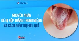 Nguyên nhân bé bị rộp trắng trong miệng và cách điều trị hiệu quả