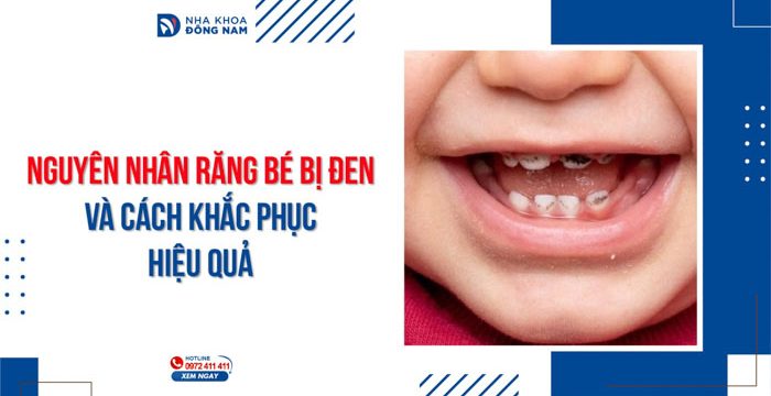 Nguyên nhân răng bé bị đen và cách khắc phục hiệu quả