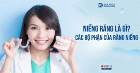 Niềng răng là gì? Các bộ phận của răng niềng