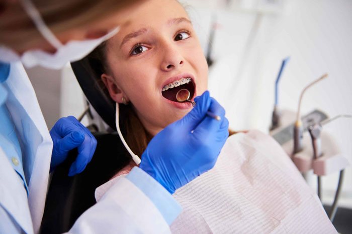 Niềng răng ở trẻ em sẽ hạn chế khả năng phải nhổ răng