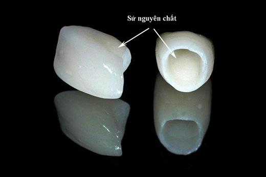 Răng sứ Zirconia được làm hoàn toàn bằng sứ nguyên chất