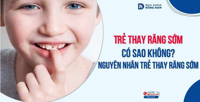 Trẻ thay răng sớm có sao không? Nguyên nhân trẻ thay răng sớm