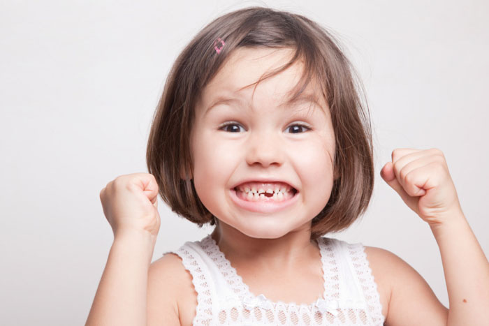 Trẻ thay răng trước 5 tuổi được đánh giá là thay răng sớm