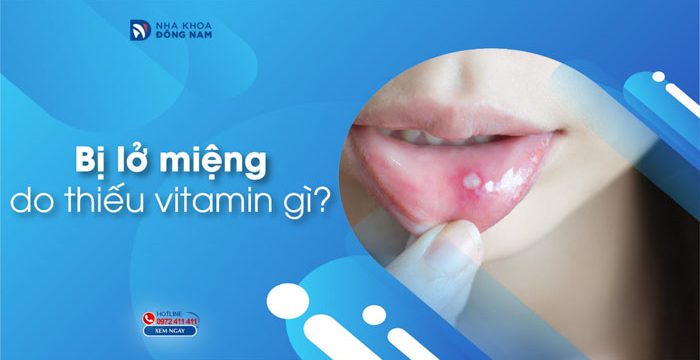 Bị lở miệng do thiếu vitamin gì?