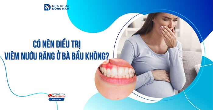 Có nên điều trị viêm nướu răng ở bà bầu không?