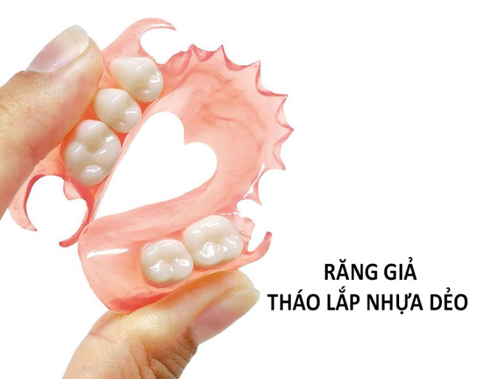 Răng giả tháo lắp nhựa dẻo là giải pháp phục hình răng mất khá phổ biến