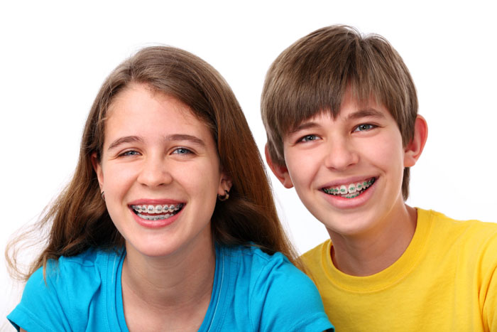 Thời gian niềng răng ở trẻ em sẽ nhanh hơn so với người lớn