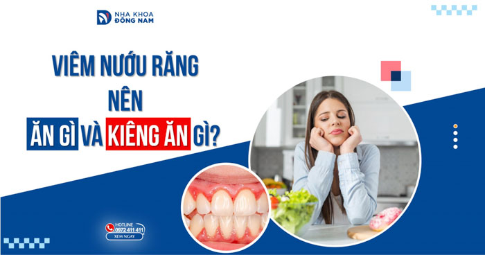 Viêm nướu răng nên ăn gì và kiêng ăn gì?