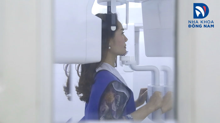 Chụp phim x-quang xác định tình trạng răng miệng cụ thể