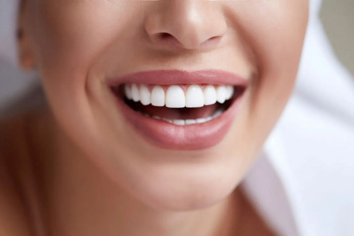 Chọn dáng răng phù hợp giúp nụ cười thêm rạng rỡ tự nhiên
