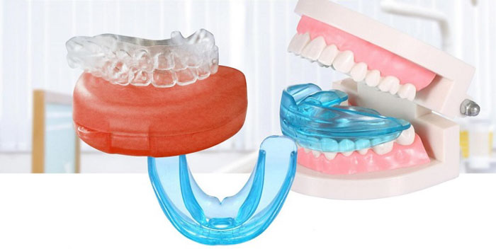 Niềng răng silicon tháo lắp tại nhà sẽ khó phù hợp kích thước với khuôn hàm
