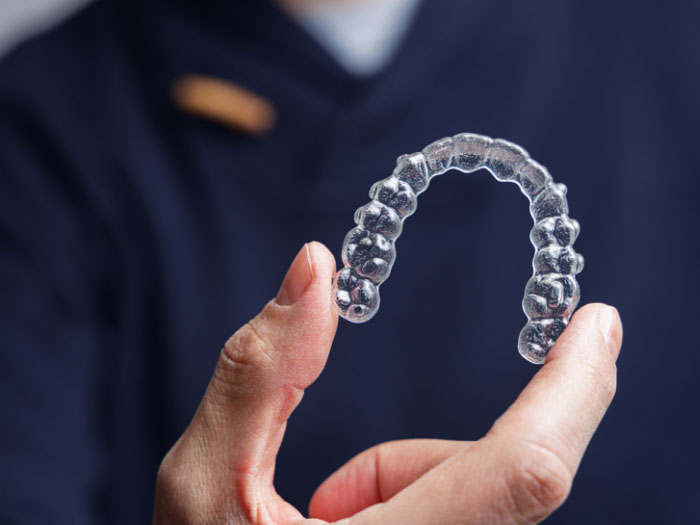 Niềng răng trong suốt Invisalign