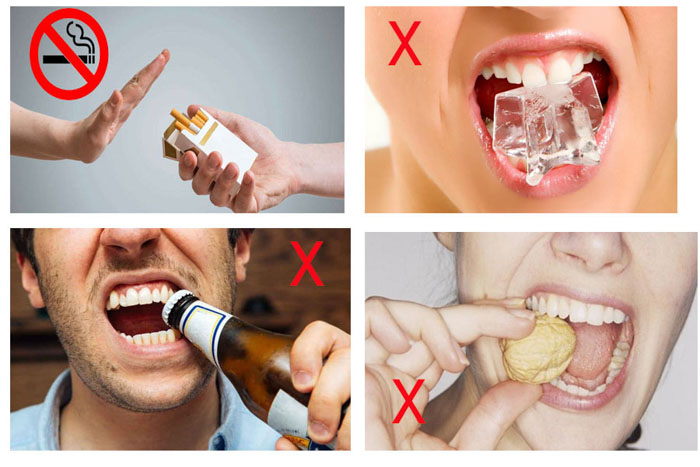 Tránh các tác động mạnh khiến răng dễ bị lung lay, gãy vỡ